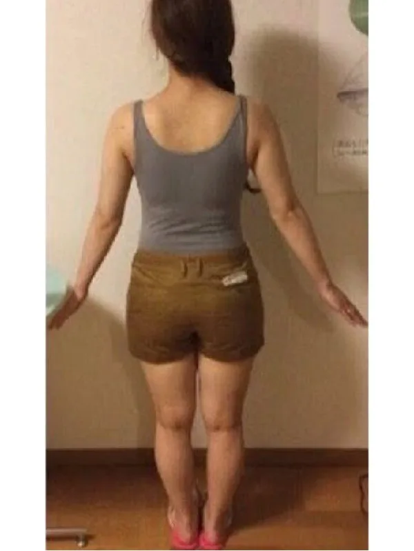 ストレス太りを解消しました！ ビフォー