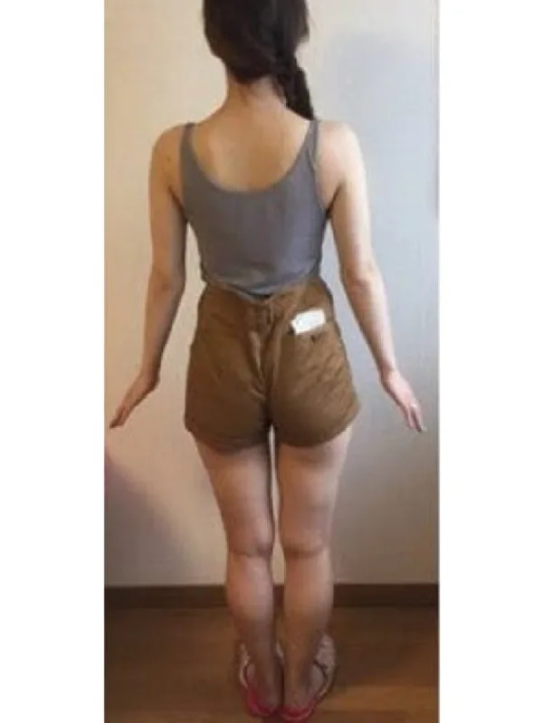 ストレス太りを解消しました！ アフター