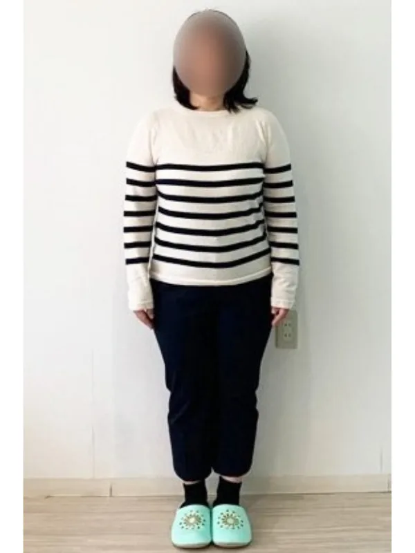 お洋服選びの幅も広がりました！ ビフォー