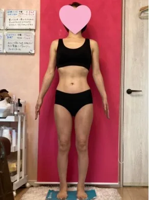 好きな服も着られて嬉しい！ アフター