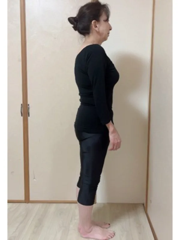 おしゃれも楽しめるように！ アフター