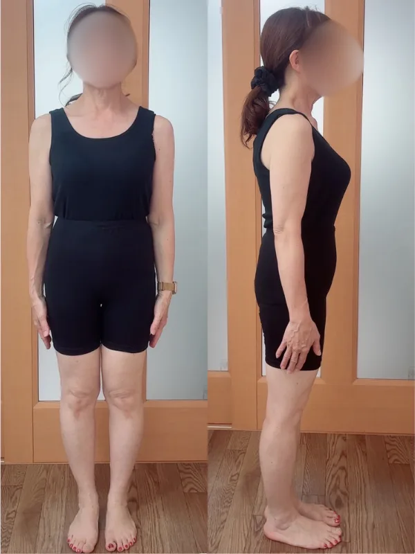 娘の結婚式で綺麗に写真をとりたい！ アフター