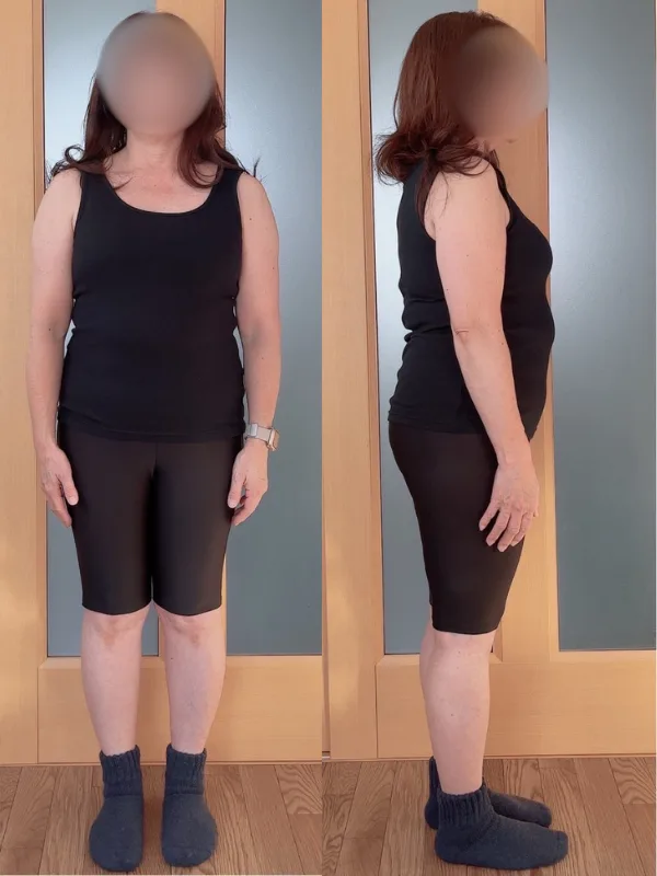 娘の結婚式で綺麗に写真をとりたい！ ビフォー