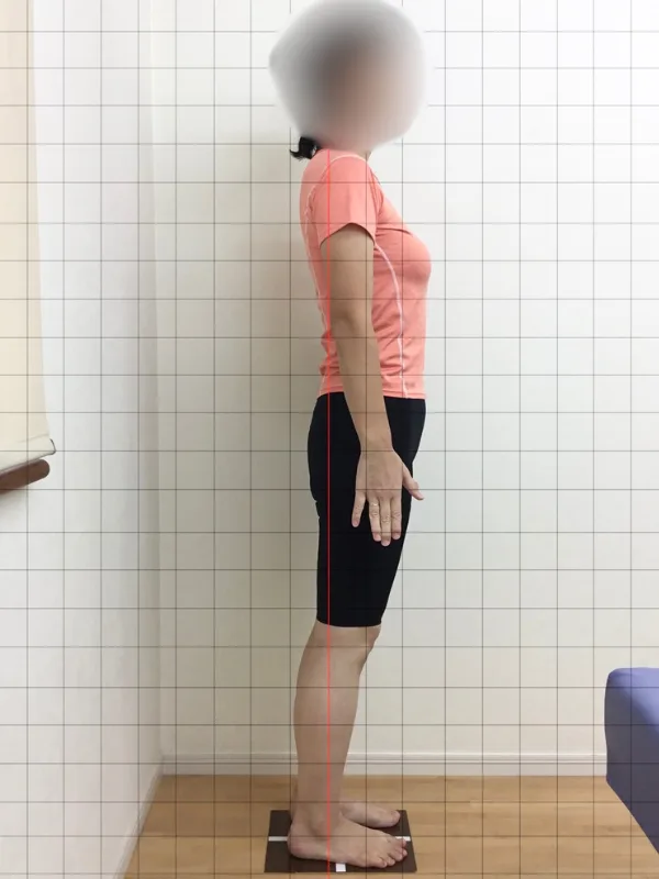 お腹もスッキリ痩せました！ アフター