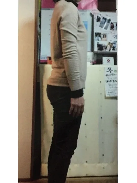 耳ツボダイエットで痩せました！ アフター