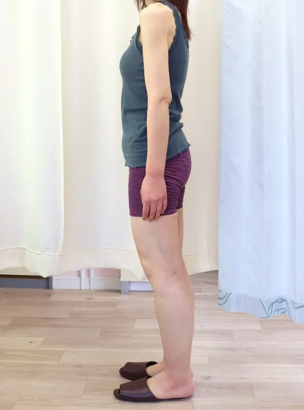 おしゃれが楽しみになりました! アフター