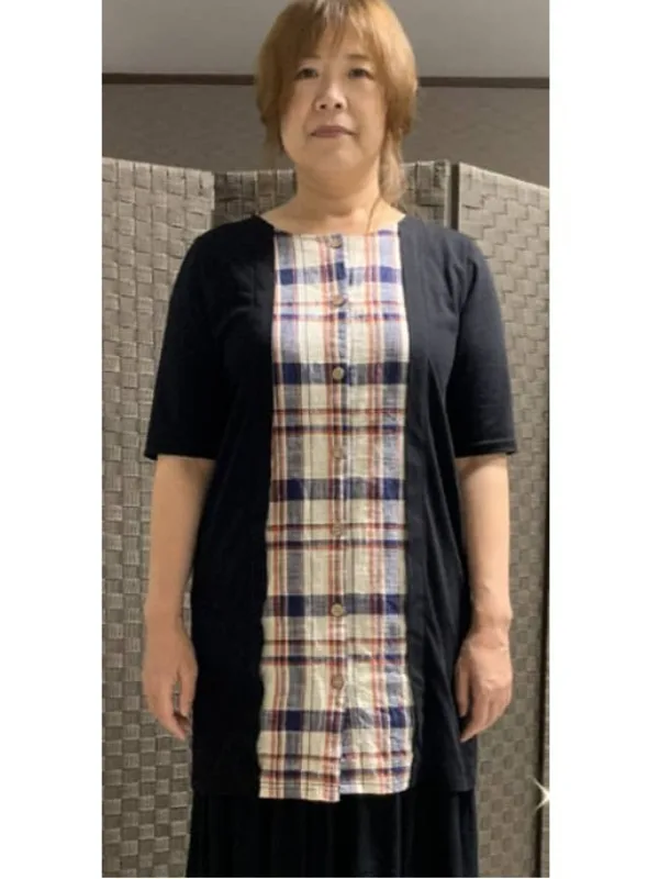 私も耳ツボダイエットで痩せました！ ビフォー