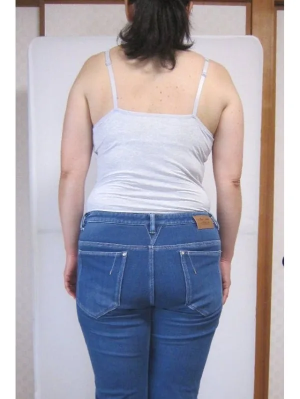 耳ツボダイエットで大幅減量に成功！ ビフォー