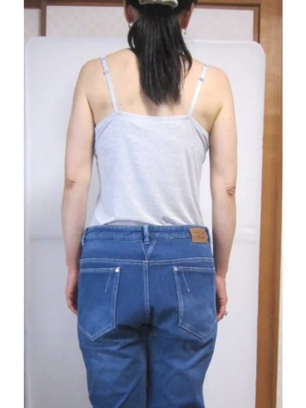 耳ツボダイエットで大幅減量に成功！ アフター