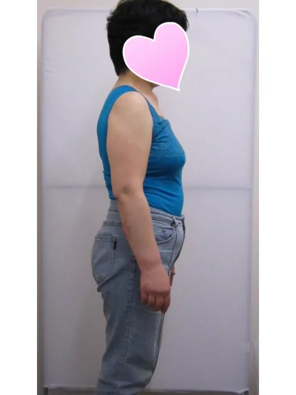 健康的にダイエットできました！ ビフォー