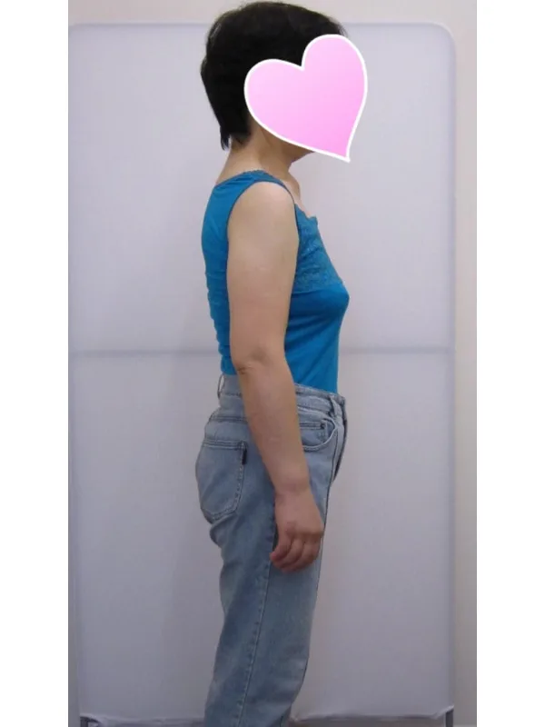 健康的にダイエットできました！ アフター