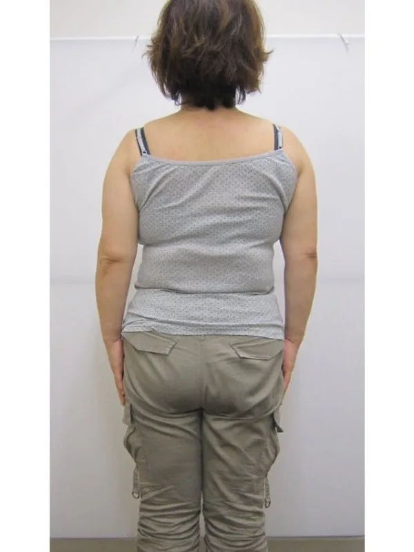 リバウンドしない自信が持てた！ ビフォー