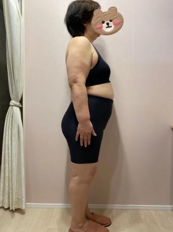 痩せてお医者様が大絶賛! ビフォー