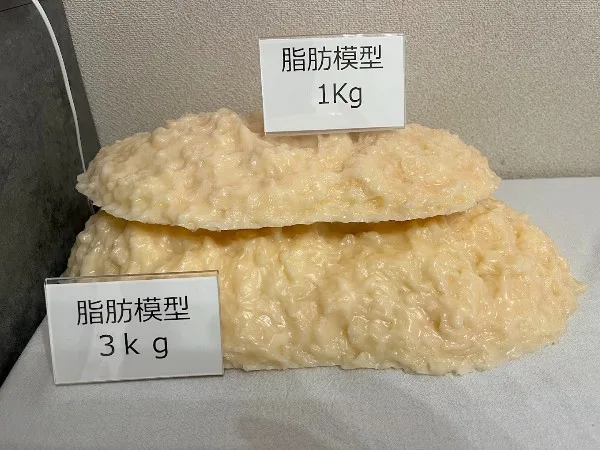 耳つぼダイエットサロンTiara