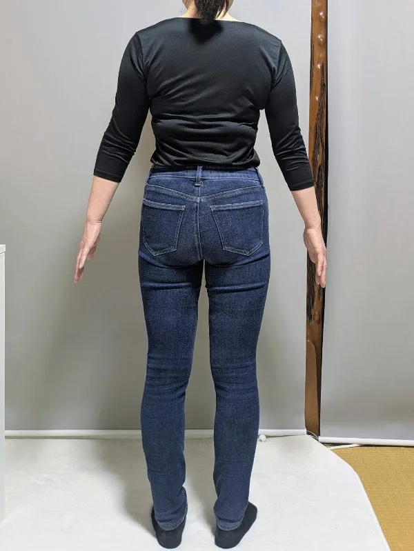 着られなかった服が着れました！ アフター