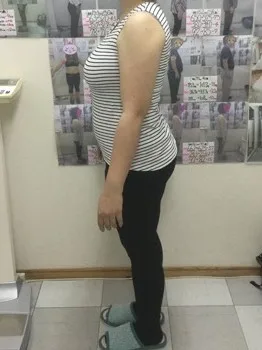 不安やストレスから解放された！ ビフォー