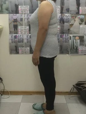 健康的にしっかり痩せました！ ビフォー